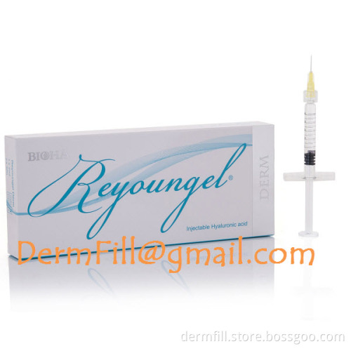 Reyoungel DERM / 2ml best under eye filler